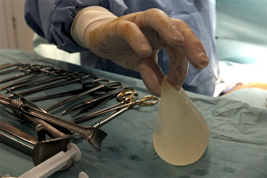 Имплантат производства PIP после извлечения из женской груди в клинике в Ницце. © Eric Gaillard/Reuters