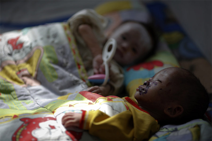 Дети, страдающие от недоедания, в больница города Хэджу. © Damir Sagolj/Reuters