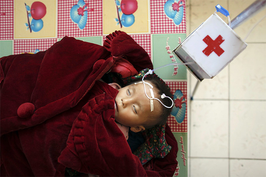 Ребенок, страдающий от сильного недоедания в больнице города Хэджу. © Damir Sagolj/Reuters