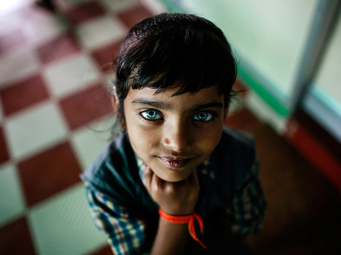 Девочка с сильными нарушениями речи и слуха в восстановительном центре в Бхопате.