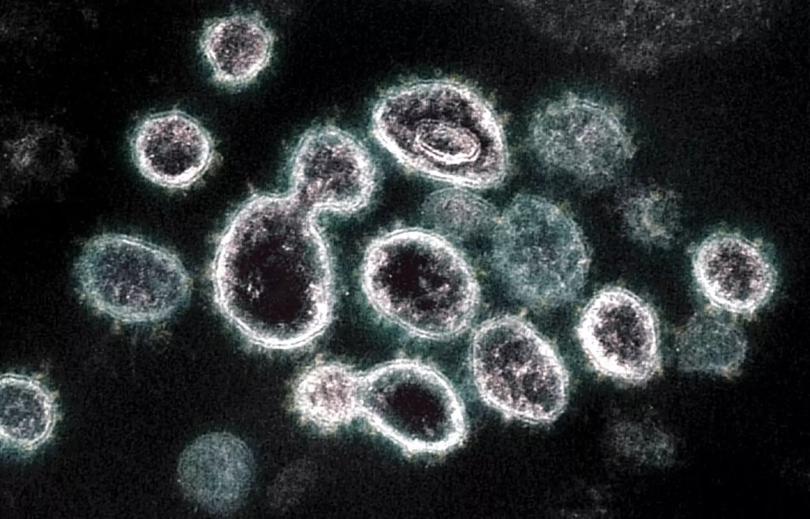 SARS-CoV-2, вирус, вызывающий Covid-19, на изображении в электронном микроскопе. 
