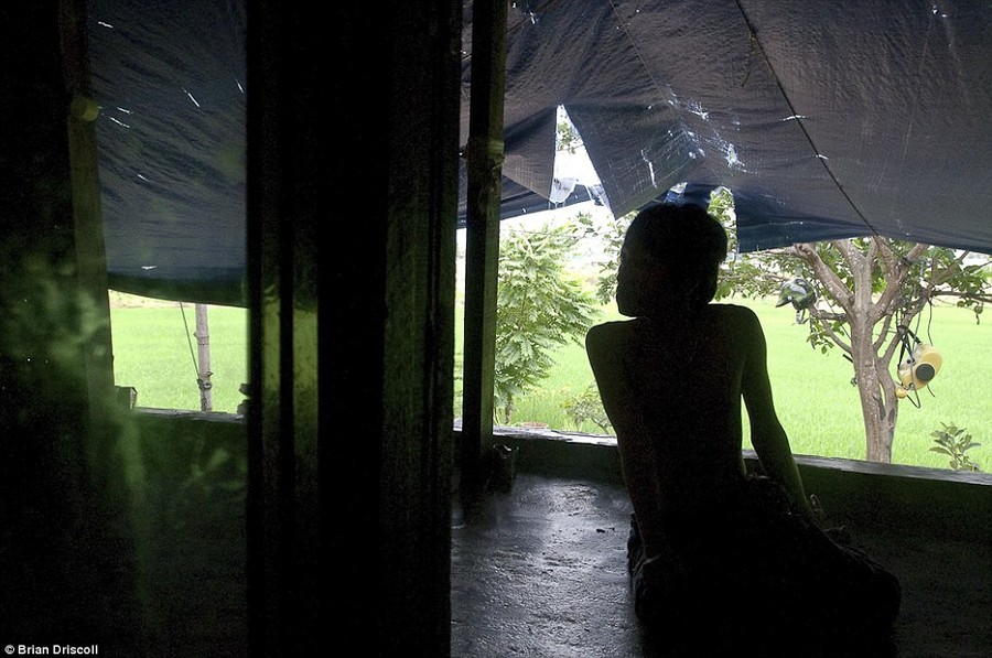 Shadow: Le Sinh, 14, Agent Orange victim, looks out from the lanai at home in the Benh Vien district, Da Nang
