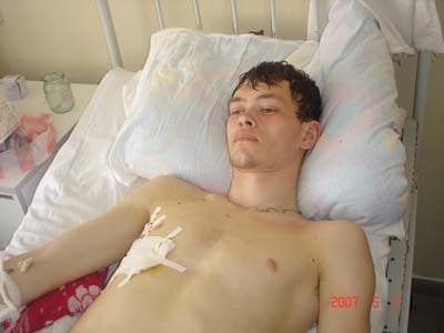 Сергей Дубинин после операции в 2007 году