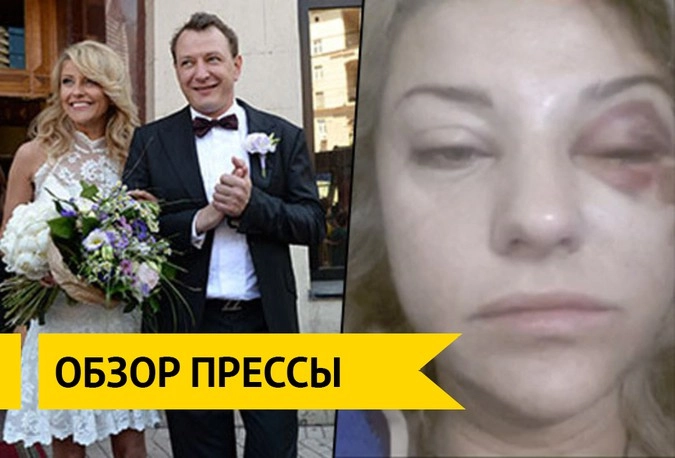Избитая жена башарова фото. Архарова побил Башаров.