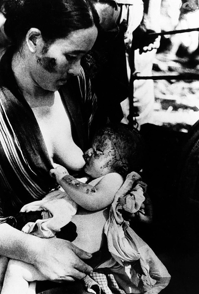 Пострадавшая во время атомной бомбардировки Нагасаки кормит своего ребенка, 10.08.1945