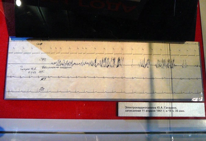 Электрокардиограмма Ю. Гагарина, записанная за день до его полета в космос.