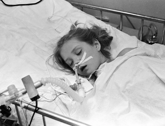 Пострадавшая от аварии на Чернобыльской АЭС девочка на больничной койке в детском хирургическом центре.