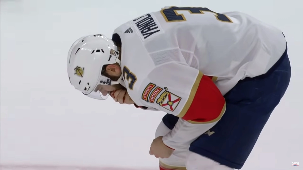 В НХЛ защитнику выбили шайбой девять зубов