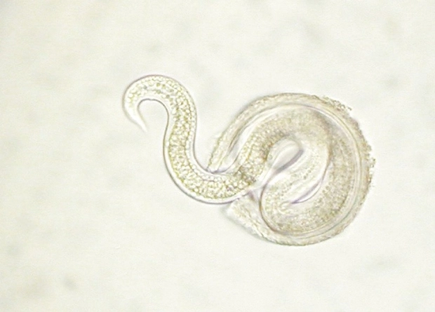 Токсокара под микроскопом.