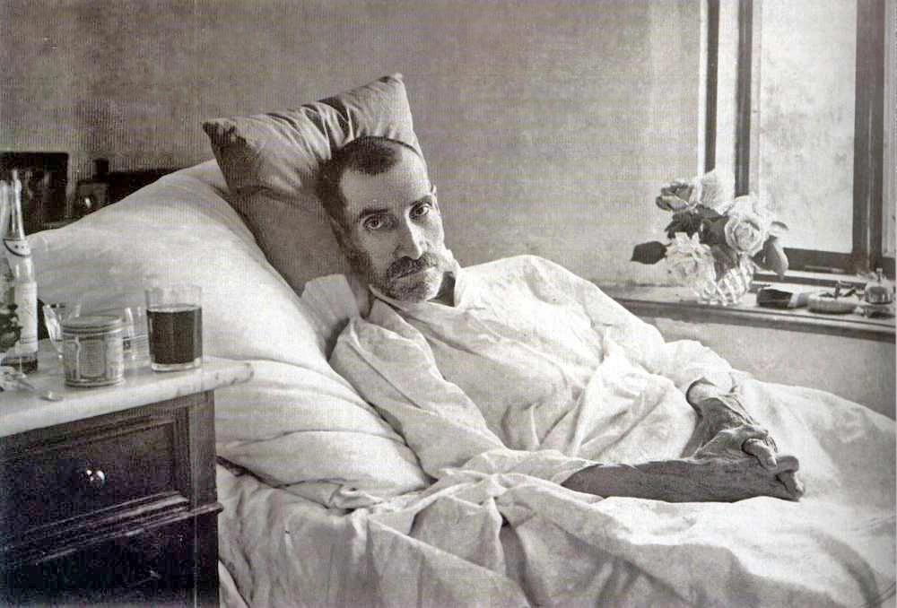 Александр Грин на смертном одре. Старый Крым. 1932 год.