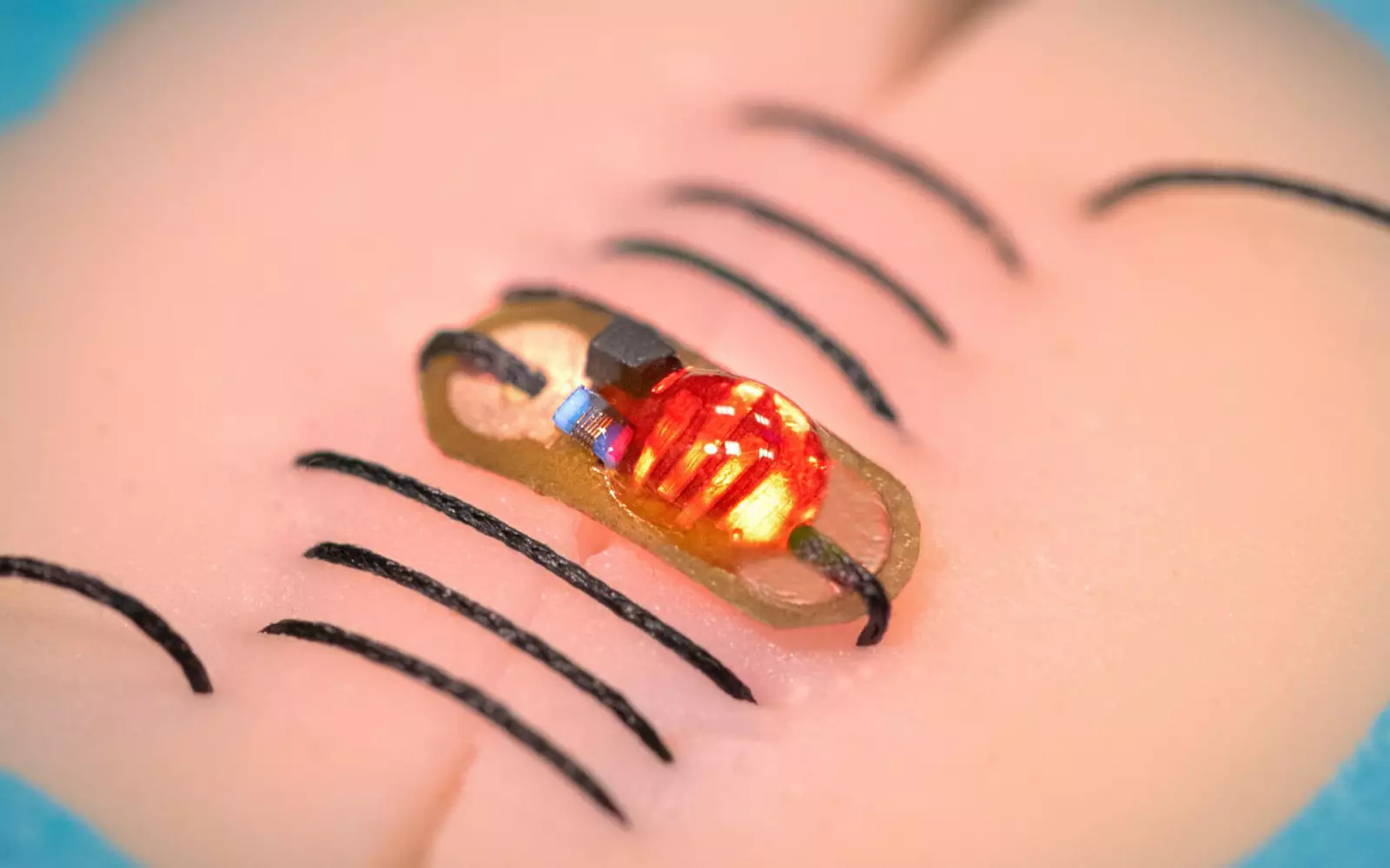 «Умные» нити. «Умные» нити.