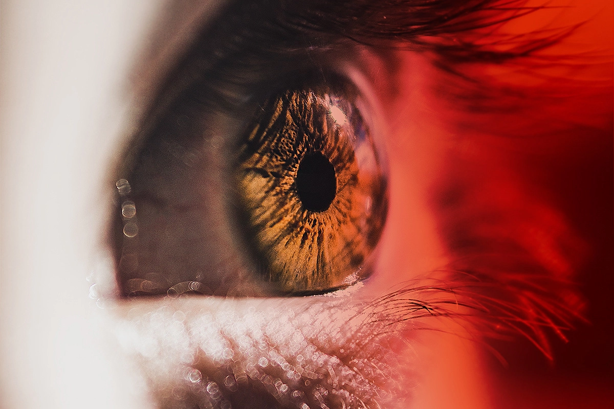 Тепловые глаза. Профилактика химических ожогов глаз. Тепловые глаза. Blue eye texture. Эписклерит конъюнктивит.