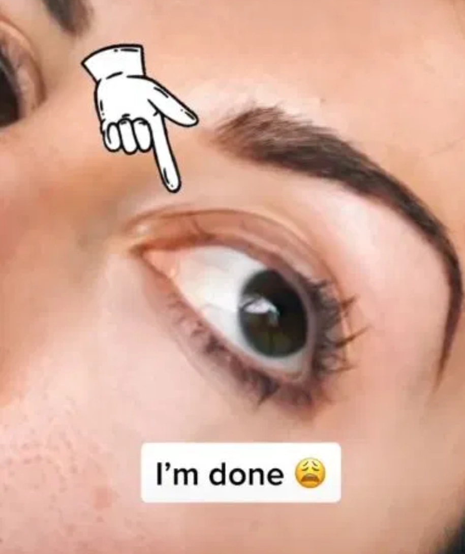 А вот как стал выглядеть глаз блогерши 