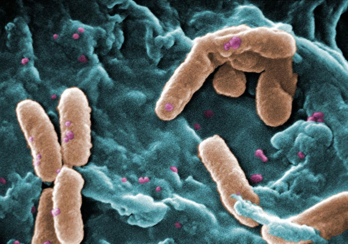 Бактерия Pseudomonas aeruginosa