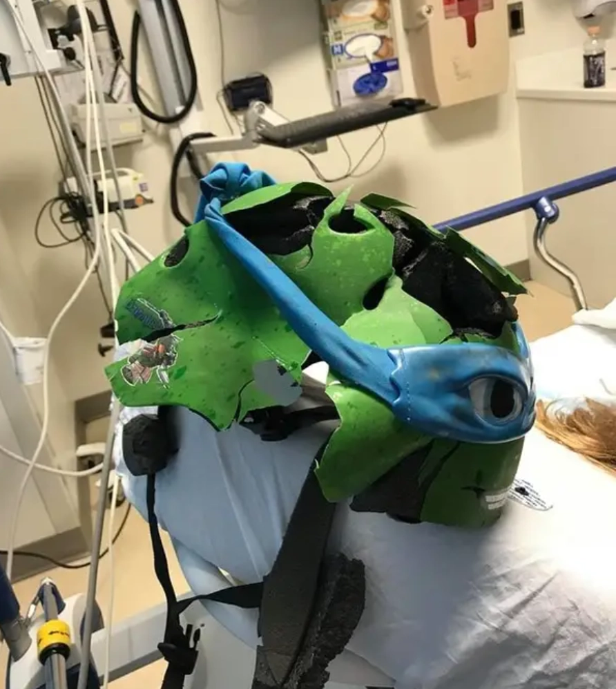 “Люди, носите шлем, если не хотите, чтобы ваша голова выглядела так”. 