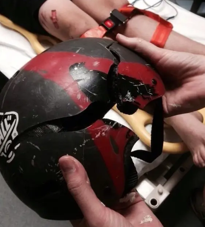 “Каждый раз, когда я смотрю на это фото, то думаю, что в моем черепе могла быть гигантская трещина”. 