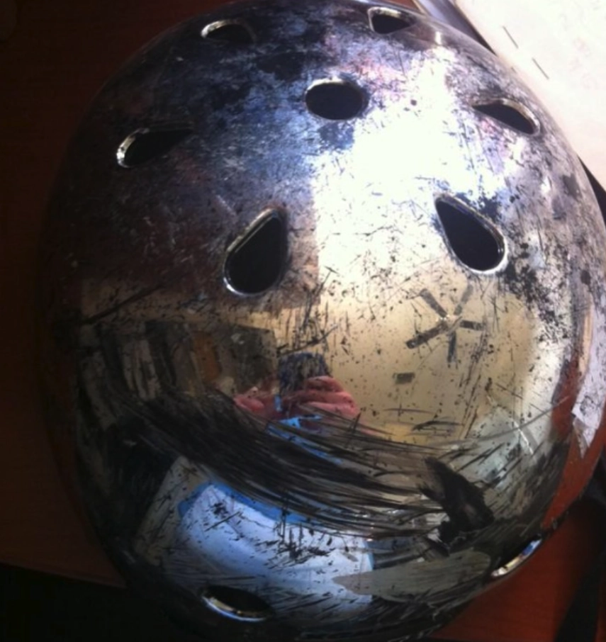 “Каждый раз, когда я смотрю на это фото, то думаю, что в моем черепе могла быть гигантская трещина”. 