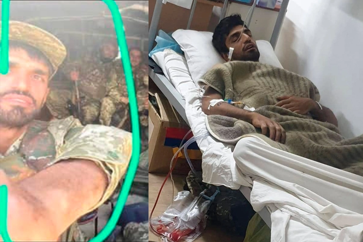 Пострадавший от полиции Егише Боцинян