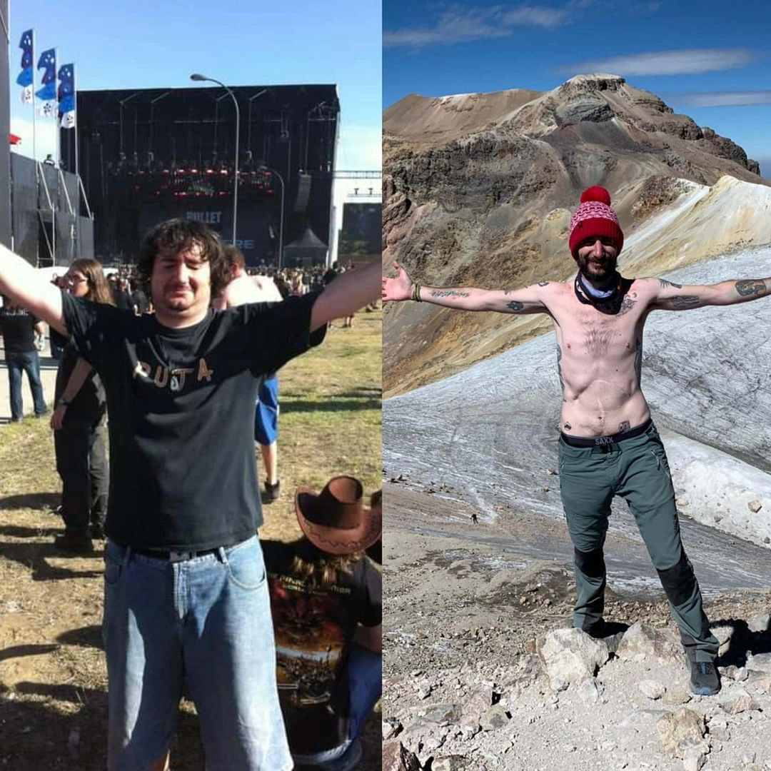 После всех пережитых операции испанец стал весить 57 килограммов и с трудом держался на ногах. 