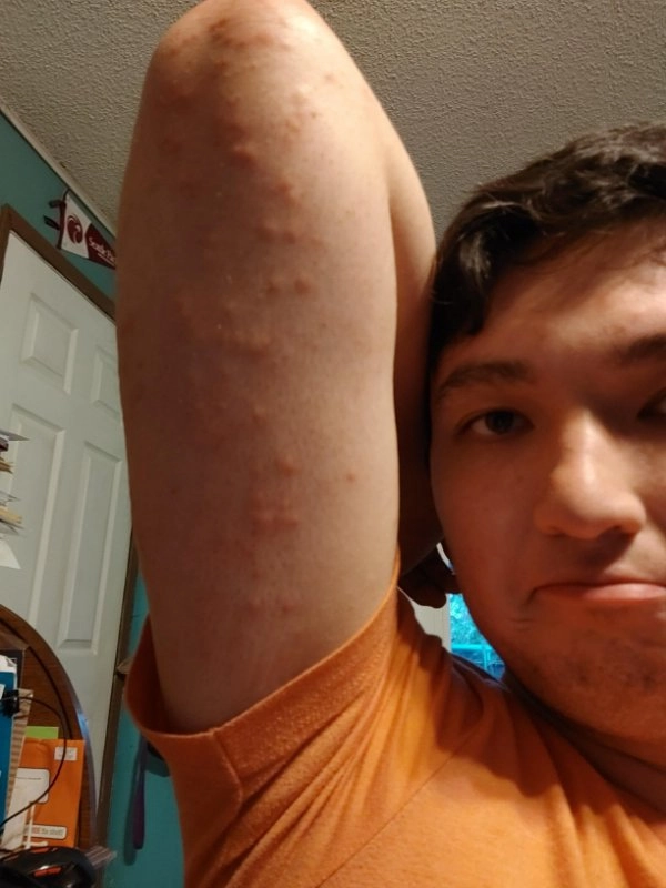 Я вам говорил, как сильно ненавижу комаров? 