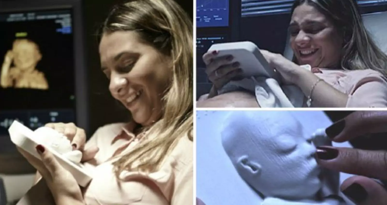 Доктор из Бразилии распечатал на 3D-принтере снимок , чтобы слепая мама увидела своего ребенка до рождения.