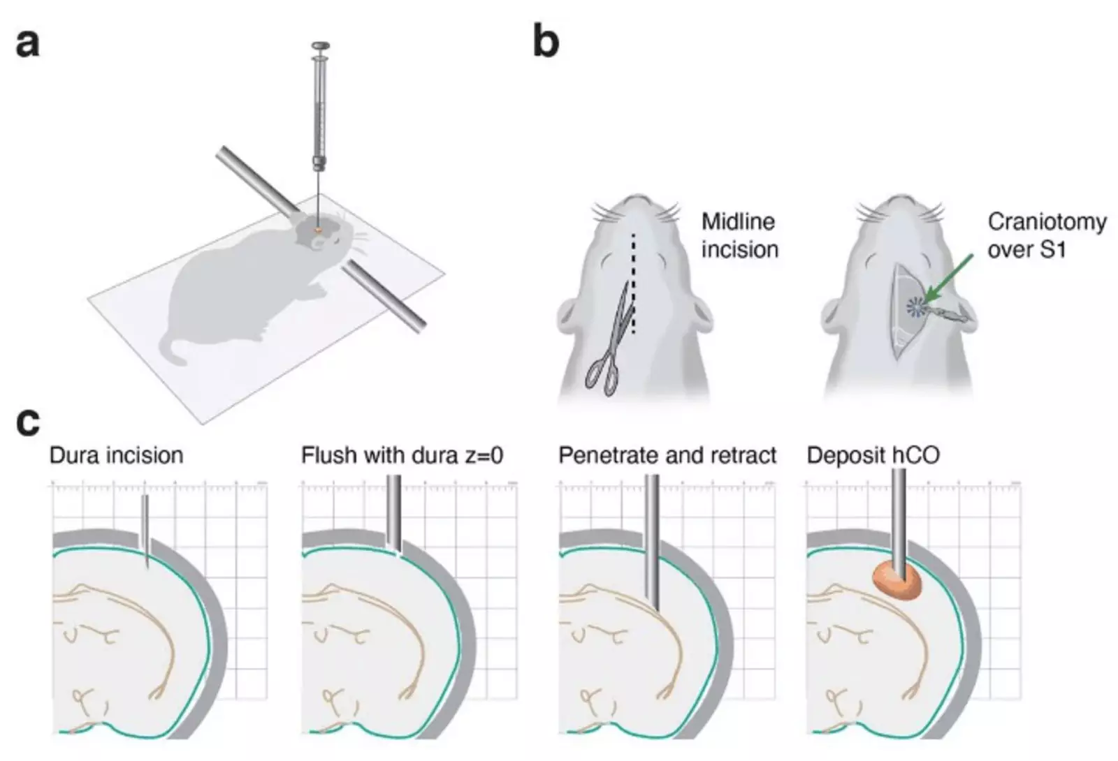 Этапы трансплантации человеческих нейронов крысе.