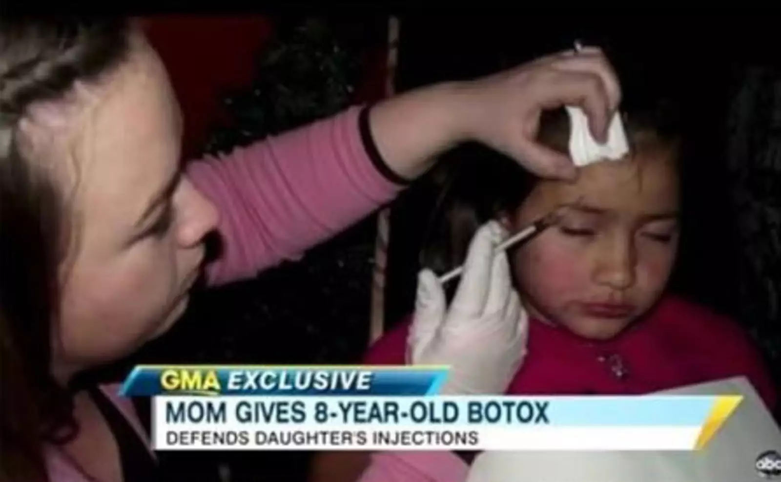 Инъекции ботокса для восьмилетней дочери. Видимо, по мнению этой матери, в этом возрасте уже появляются морщины.