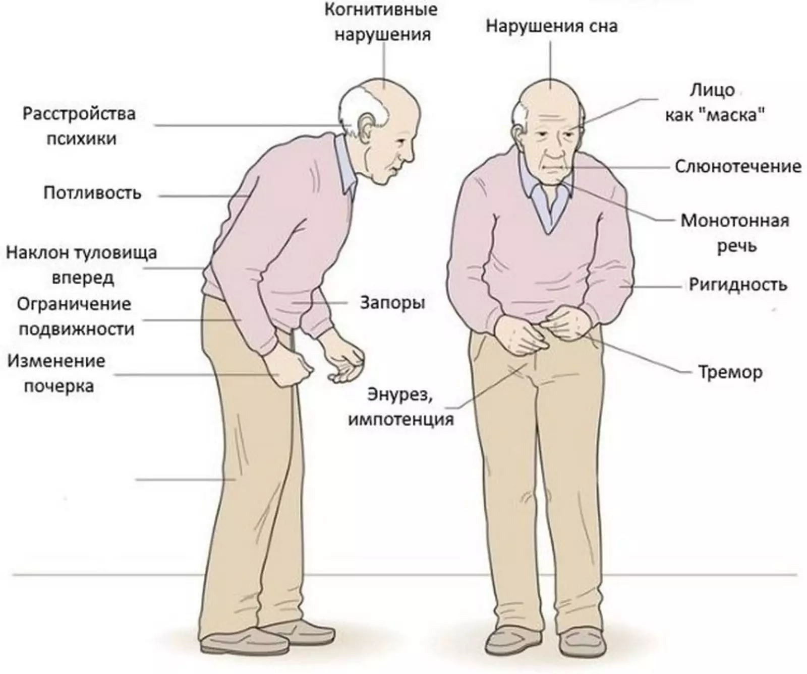 Клиники лечение болезни паркинсона