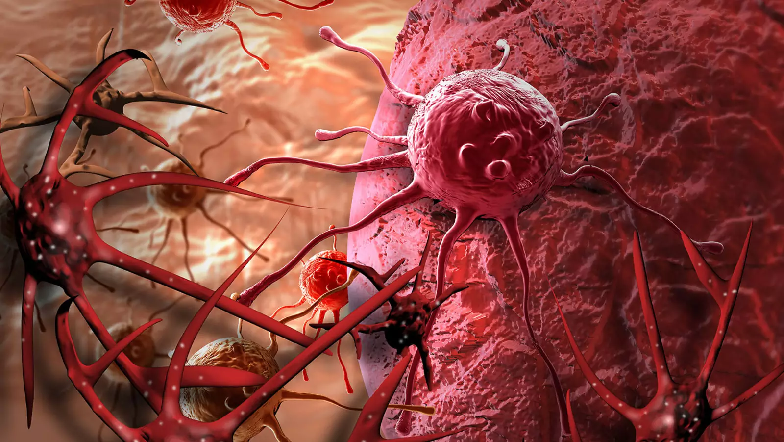 Хроническое воспаление может привести к раку. Хроническое воспаление может привести к раку.