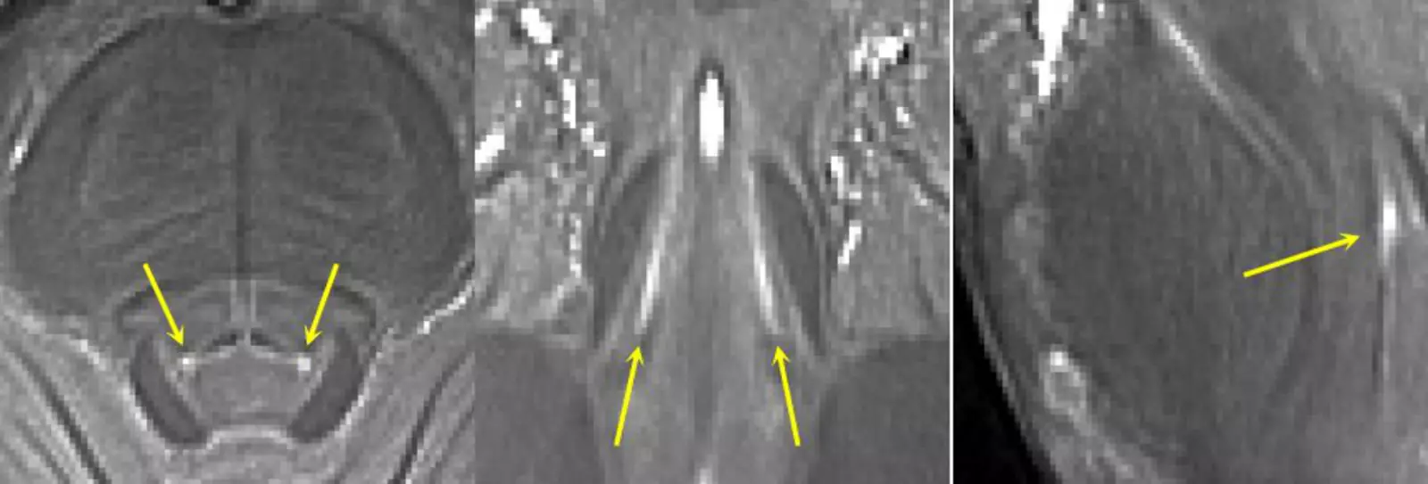 олубое пятно на МРТ-сканере 7T. 