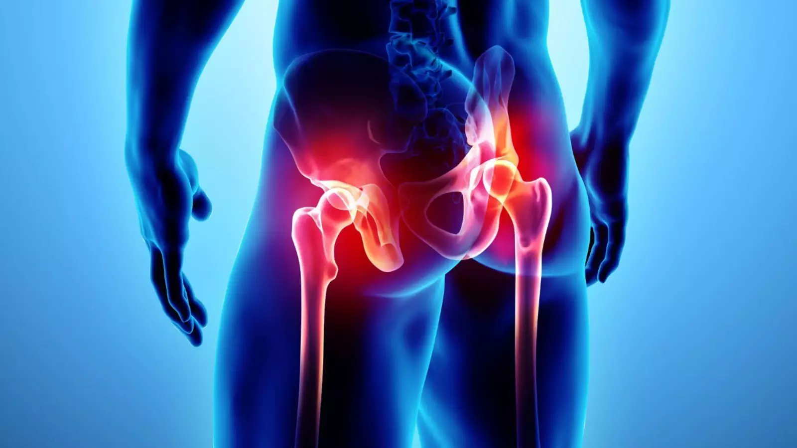 Тазобедренный сустав лечение врач. Hip Joint Pain. Коксалгия тазобедренного сустава. Тазобедренный сустав болит. Бдль тазобедренный сустав.