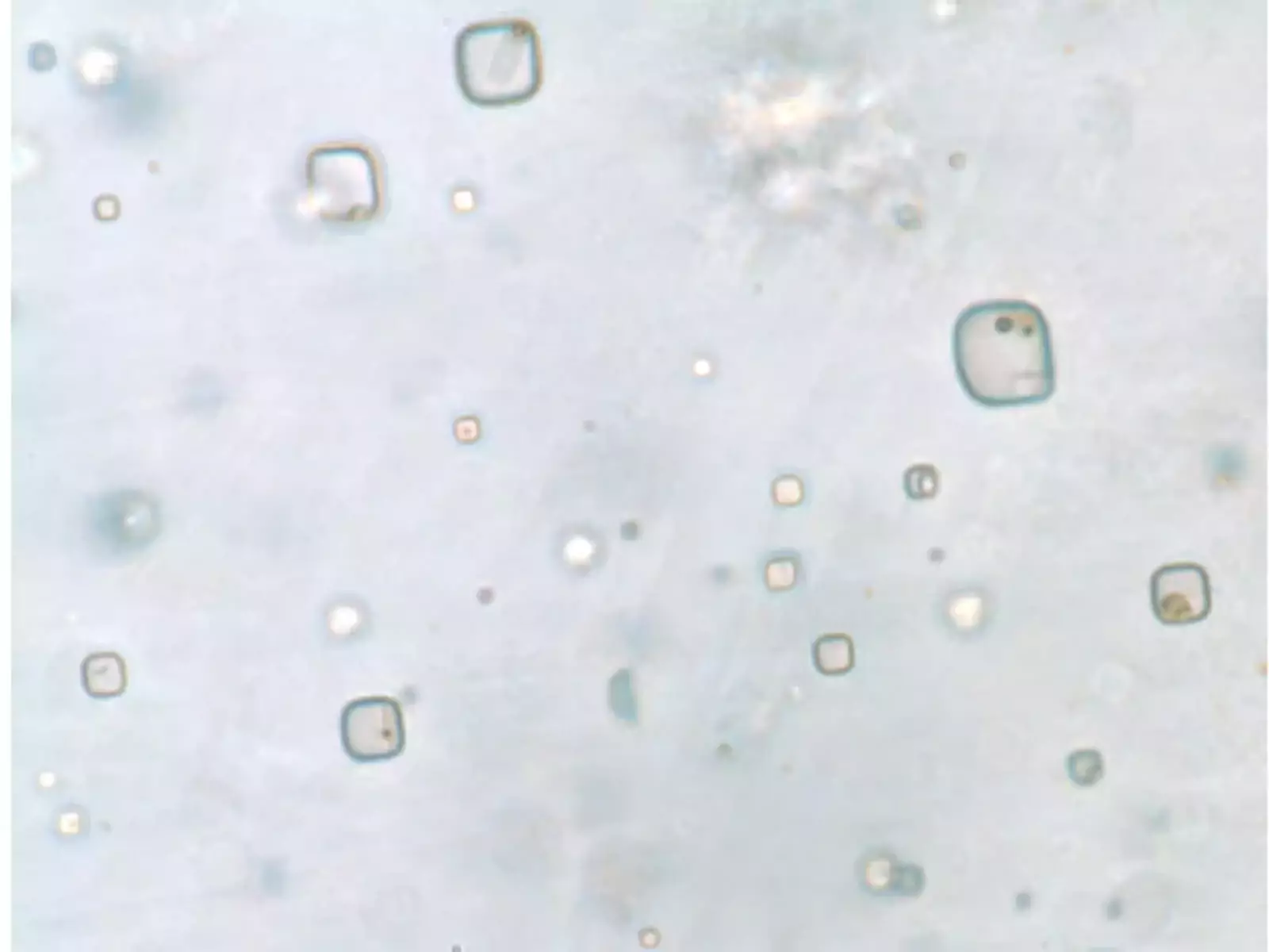 Многовековые микроорганизмы внутри кристаллов соли.