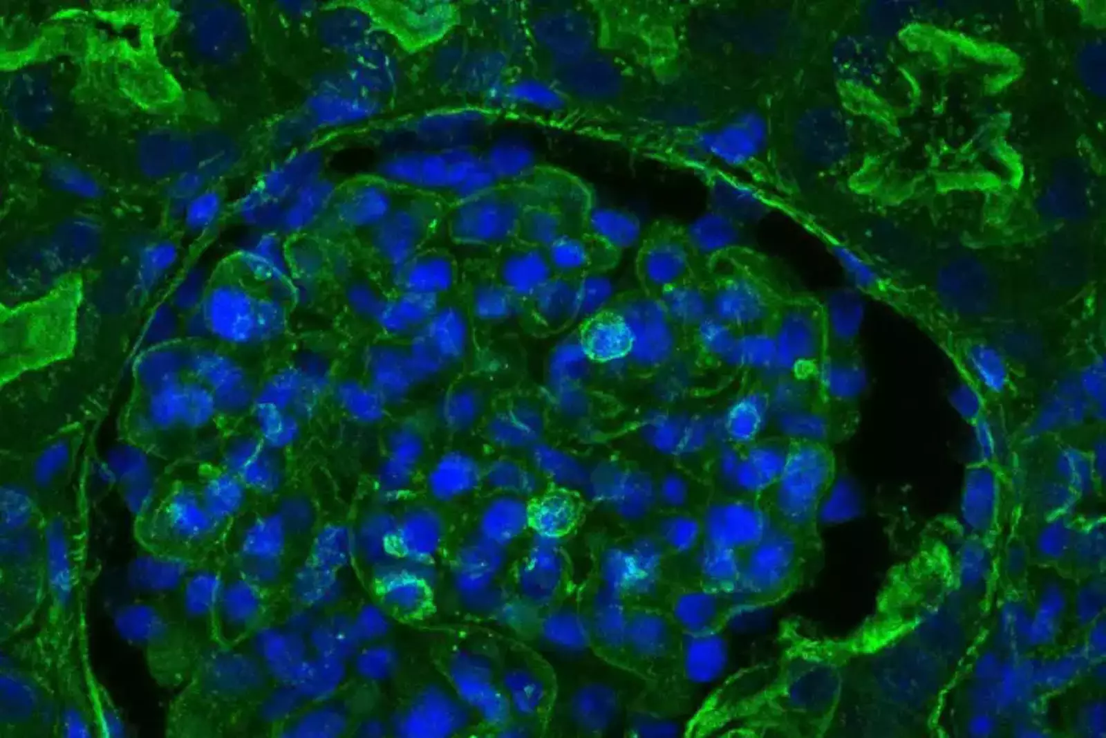 Ткань почки свиньи после лечения OrganEx. Зеленое пятно показывает бета-актин цитоскелета, который выглядит более тусклым, если клетка повреждена.