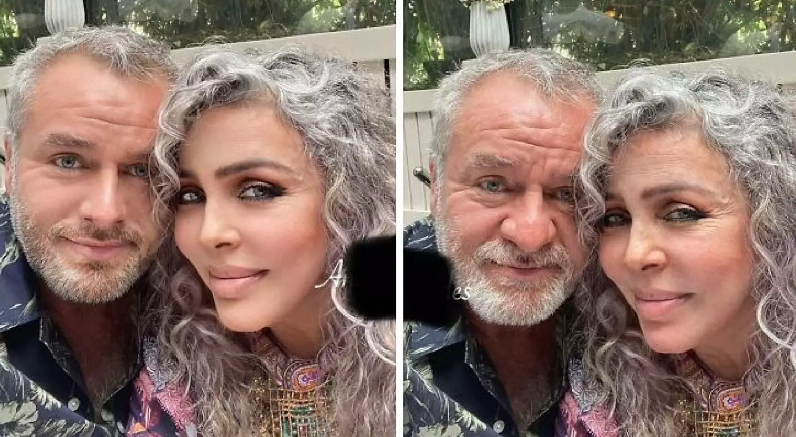 Мгновенное омоложение. Мгновенное омоложение.