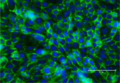 ВИЧ-инфицированная микроглия.