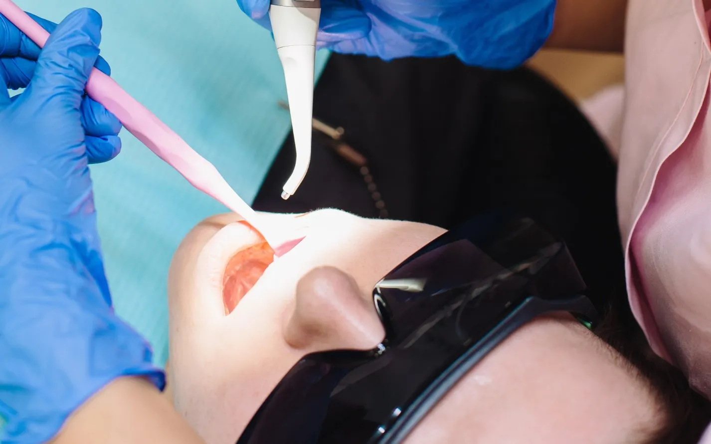 Лечение зубов.