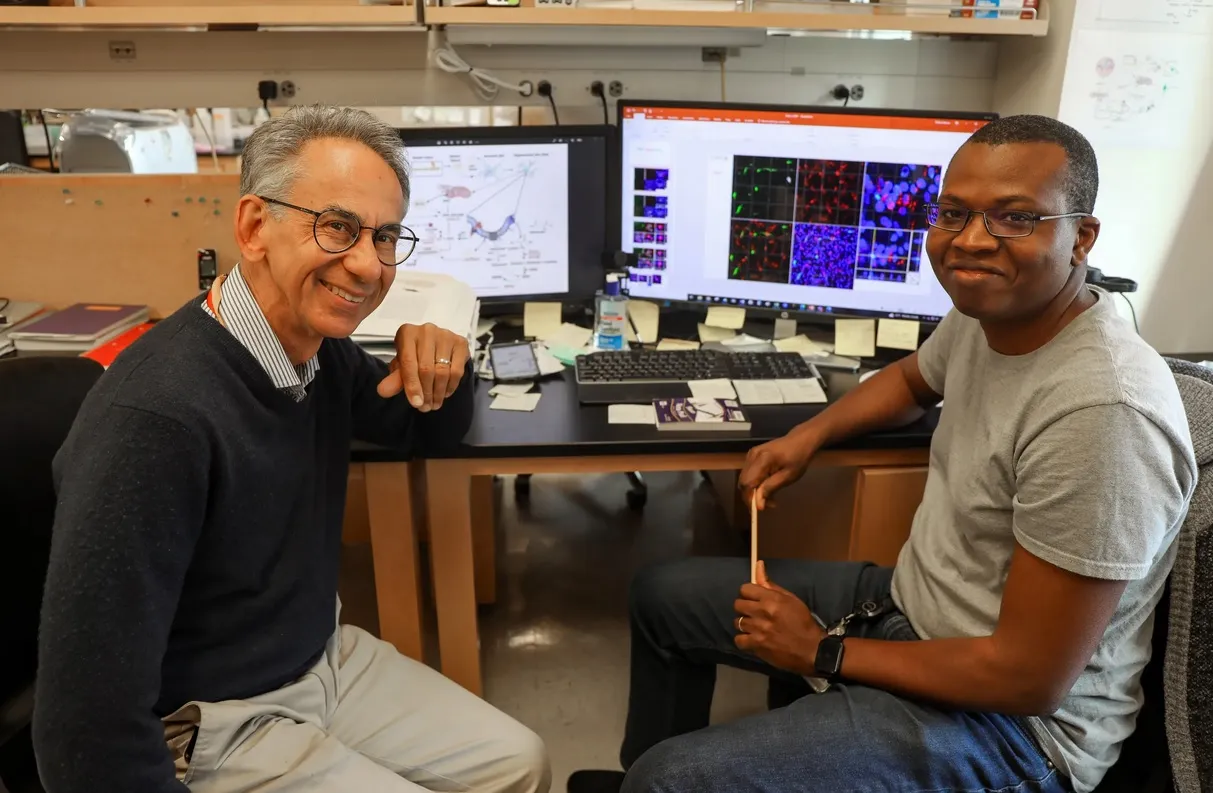 Авторы исследования выяснили, что при развитии болезни Альцгеймера первым начинает страдать белое вещество мозга.