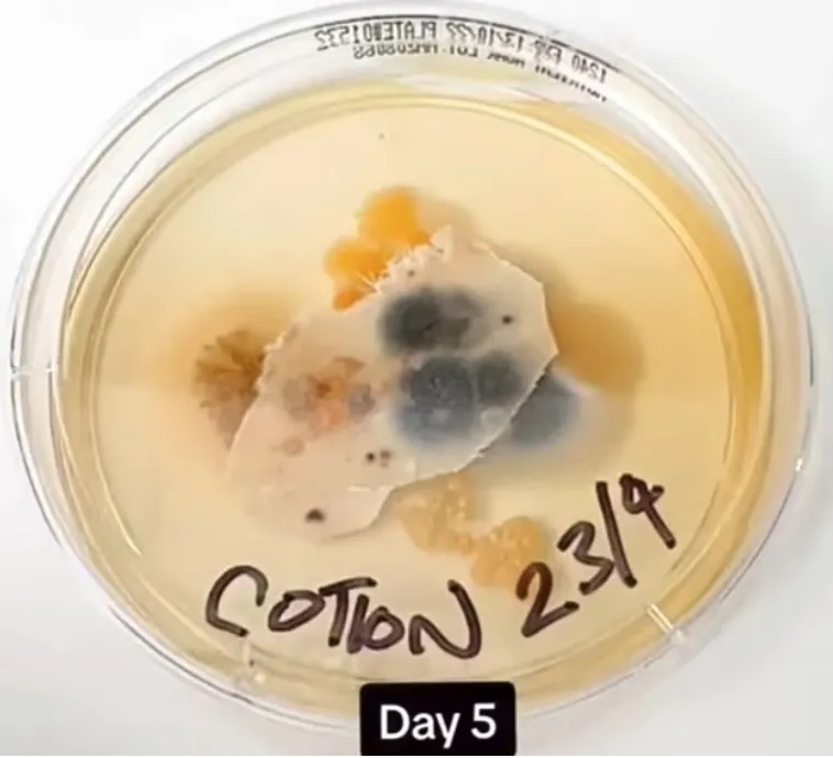 Спустя пять дней инкубации дерматологи собрали богатый урожай из бактерий и грибков, живущих на постельном белье.