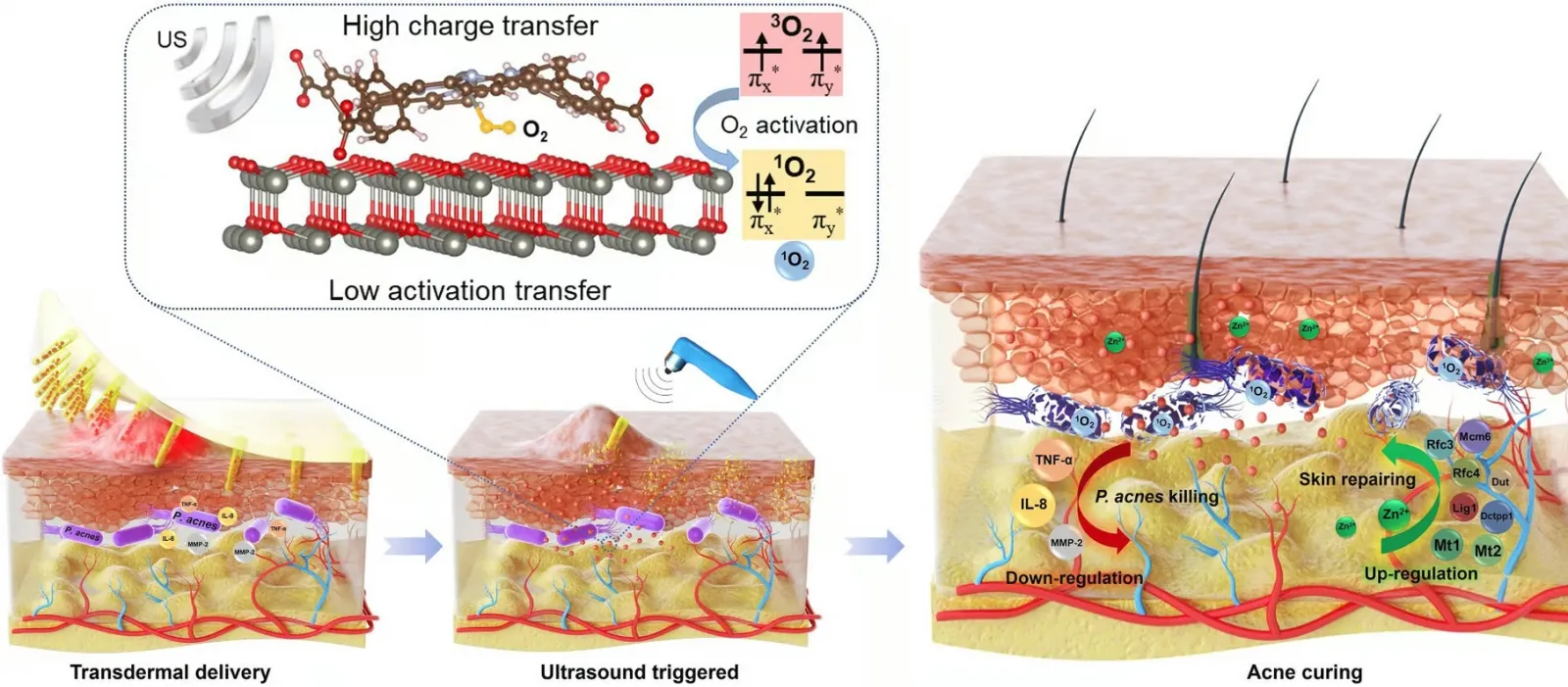 Схематический принцип работы пластыря.
