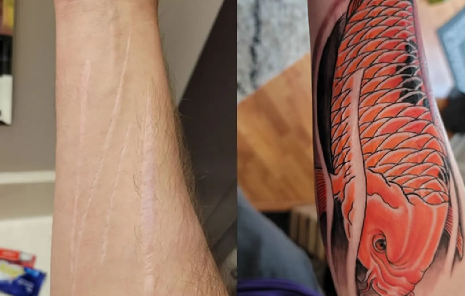 Необычные татуировки. Татуировка скрыть шрам. Перекрытие шрамов татуировкой. Красивое перекрытие шрамов. Тату на шрамах на руке для девушек.