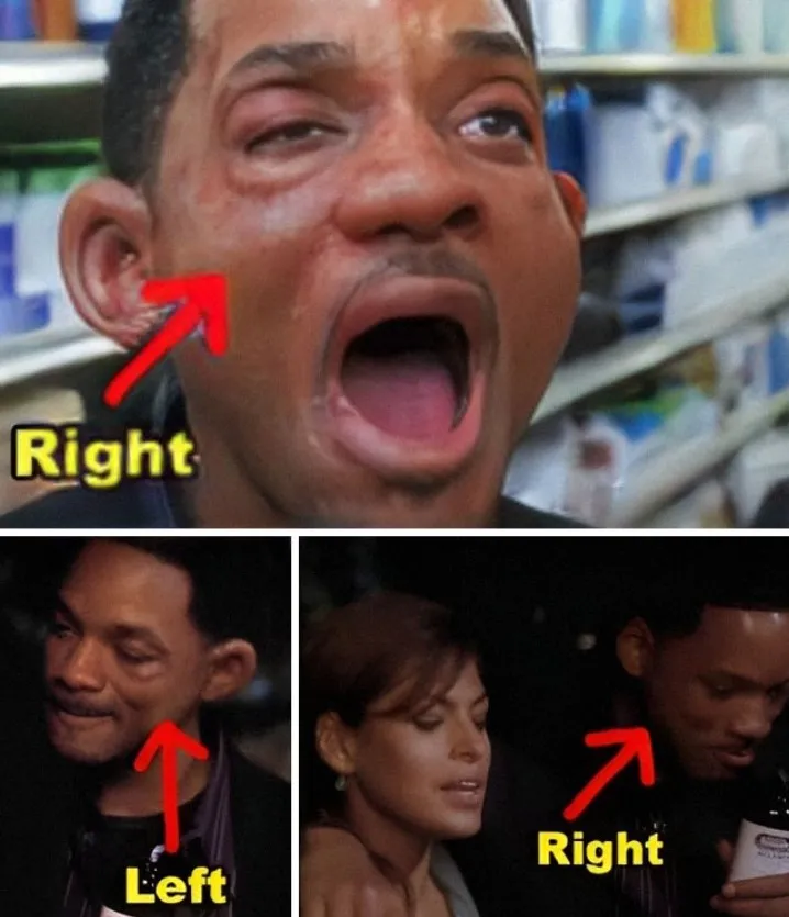 Перемещающиеся раны.