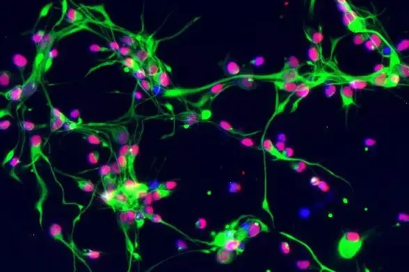 Нервные стволовые клетки человека, полученные с помощью флуоресцентной микрофотографии.