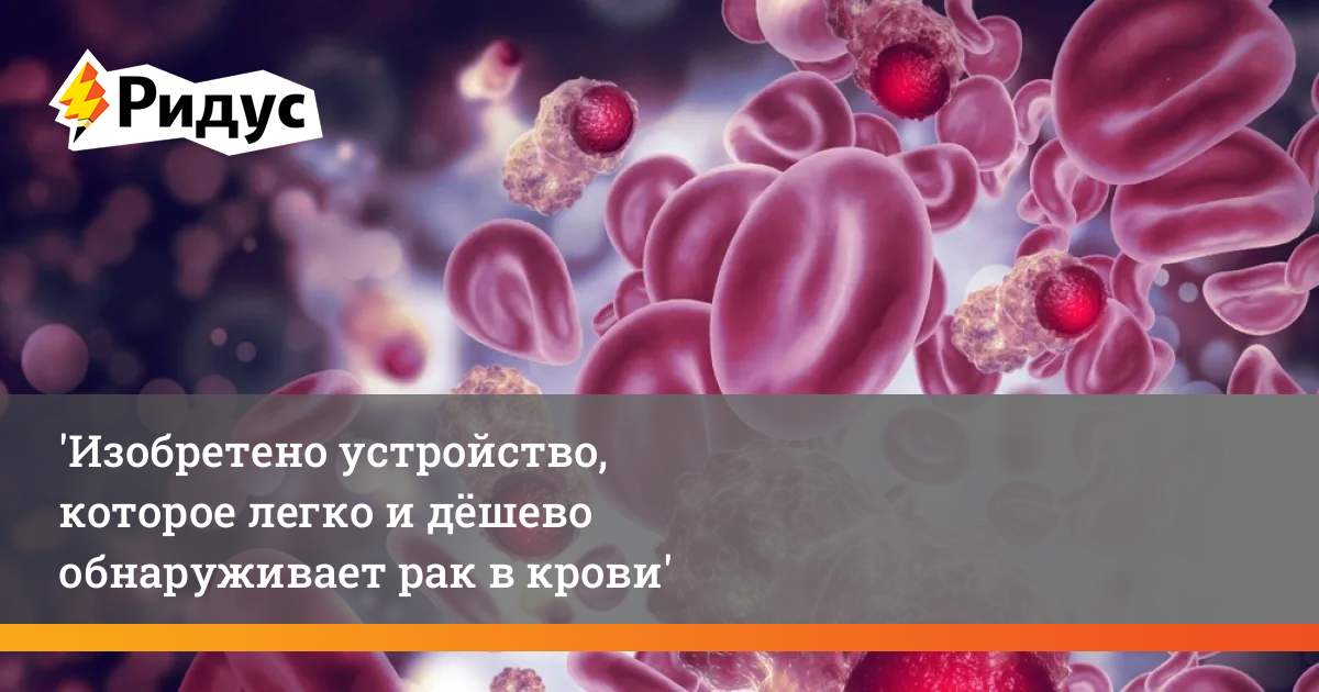 Изобретено устройство, которое легко и дёшево обнаруживает рак в крови