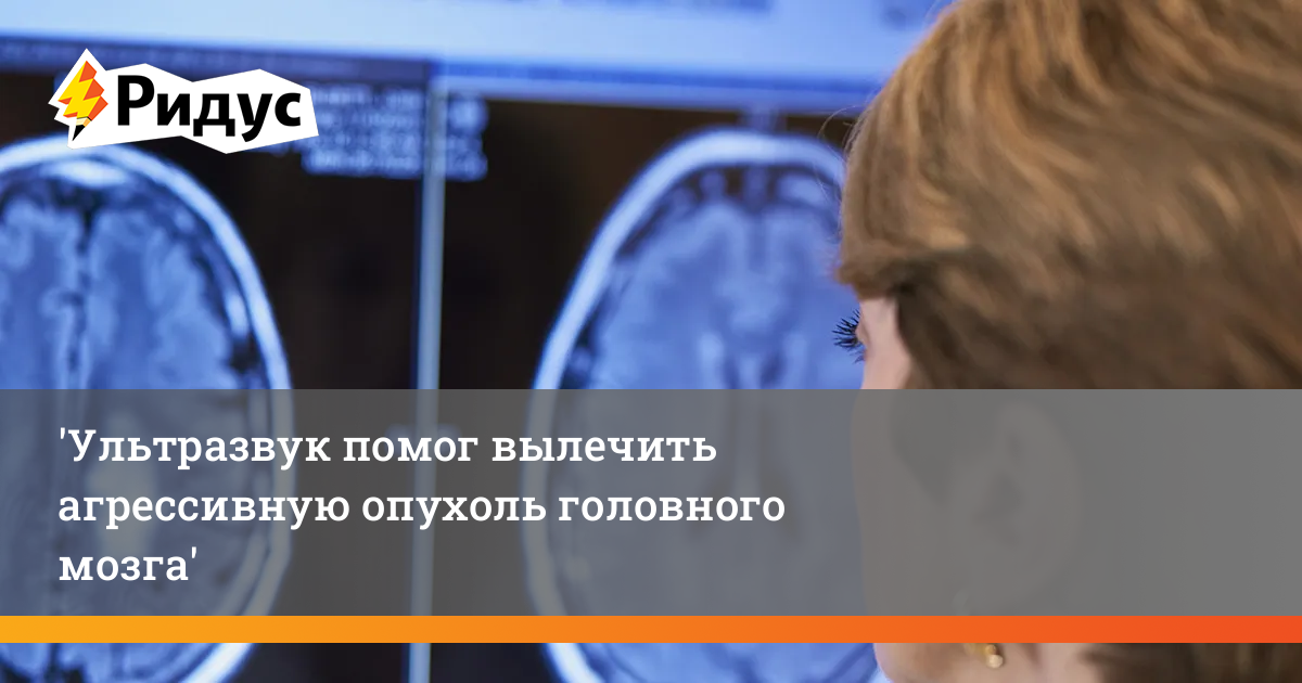 Ультразвук помог вылечить агрессивную опухоль головного мозга