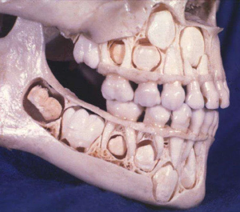 Это череп ребенка, у которого еще не выпали молочные зубы. Жутко, но интересно.
