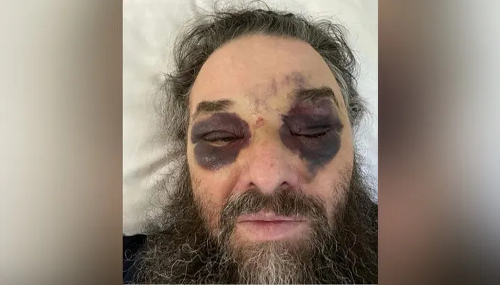 Избитый митрополит Лонгин.