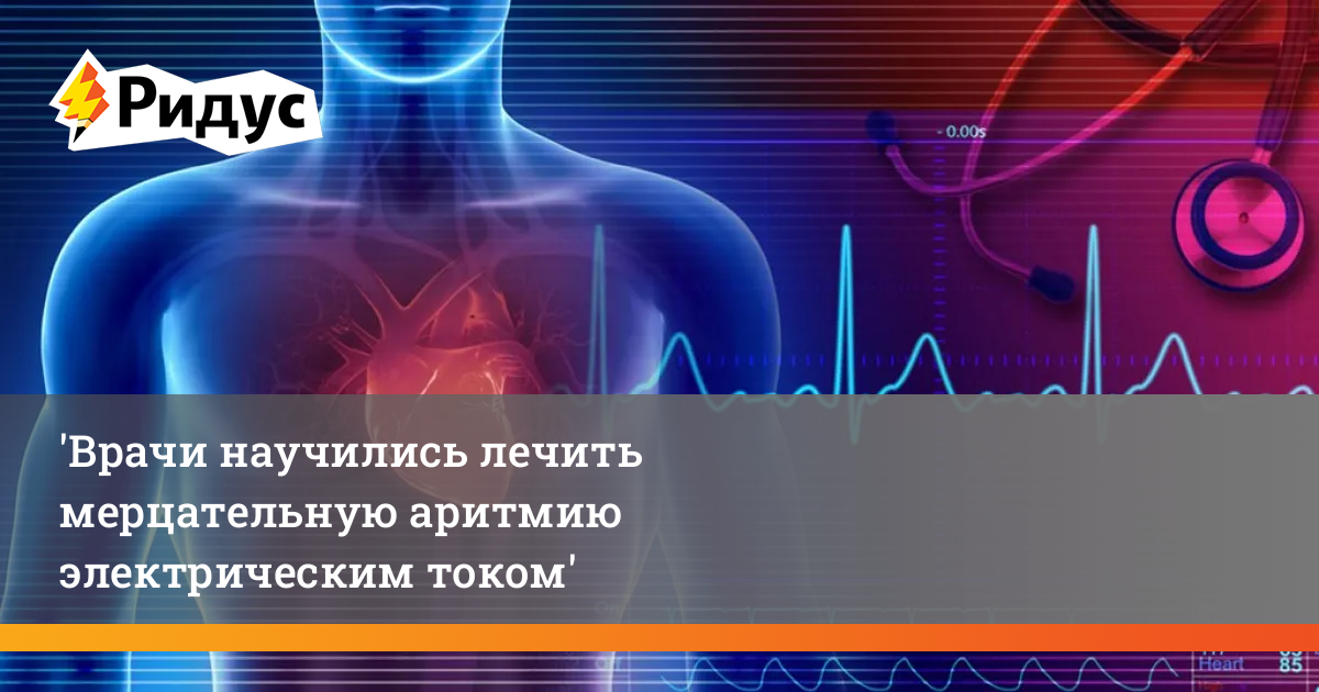 Врачи научились лечить мерцательную аритмию электрическим током