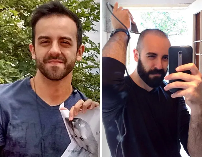 «Недавно, после долгого периода неуверенности в себе из-за выпадения волос, я решил побрить голову и отрастить более густую бороду».