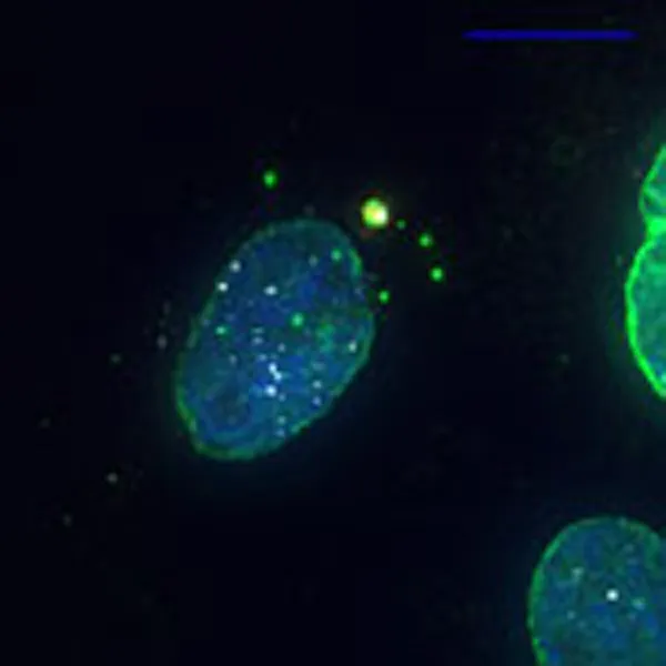 Эксклюсома представляет собой на снимке ярко-зелёную точку.