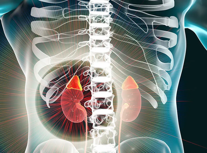 Гипертония может развиться вследствие редкого заболевания надпочечников.